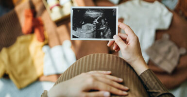 A pregnant woman looks at an ultrasound image of her unborn baby.