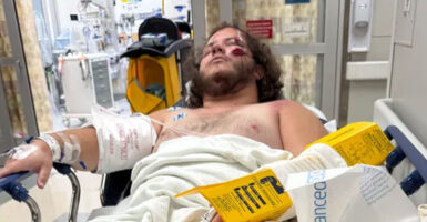 A bandaged Florida man, Zach Carach, recovers from a hit-and-run accident in a hospital bed.