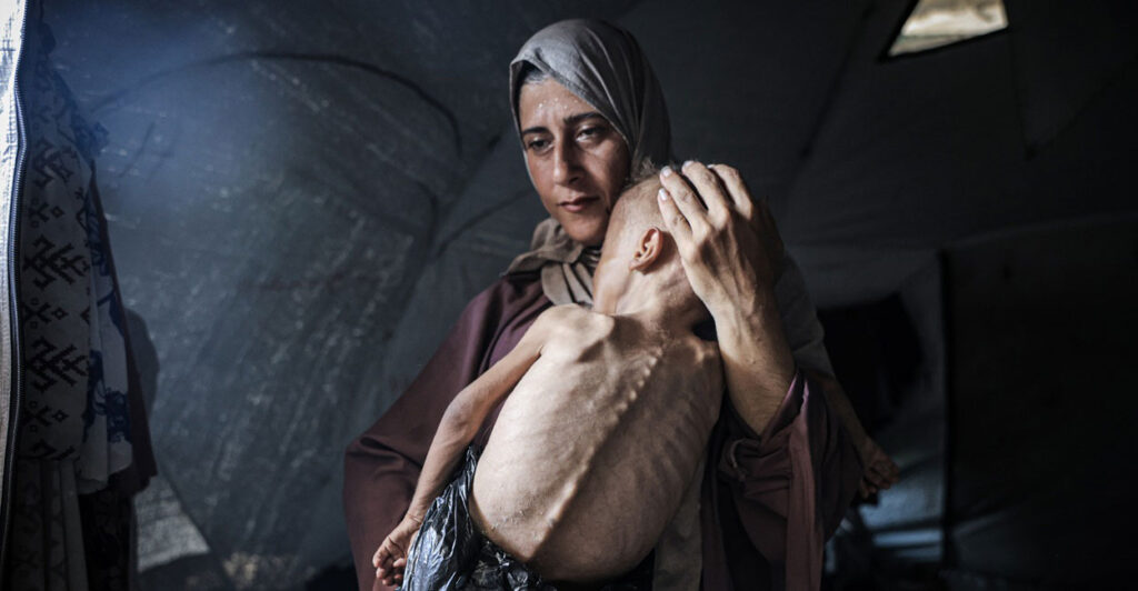 A Palestinian woman holds a child diagnosed with pre-existing congenital health issues, including brain complications and muscle atrophy.
